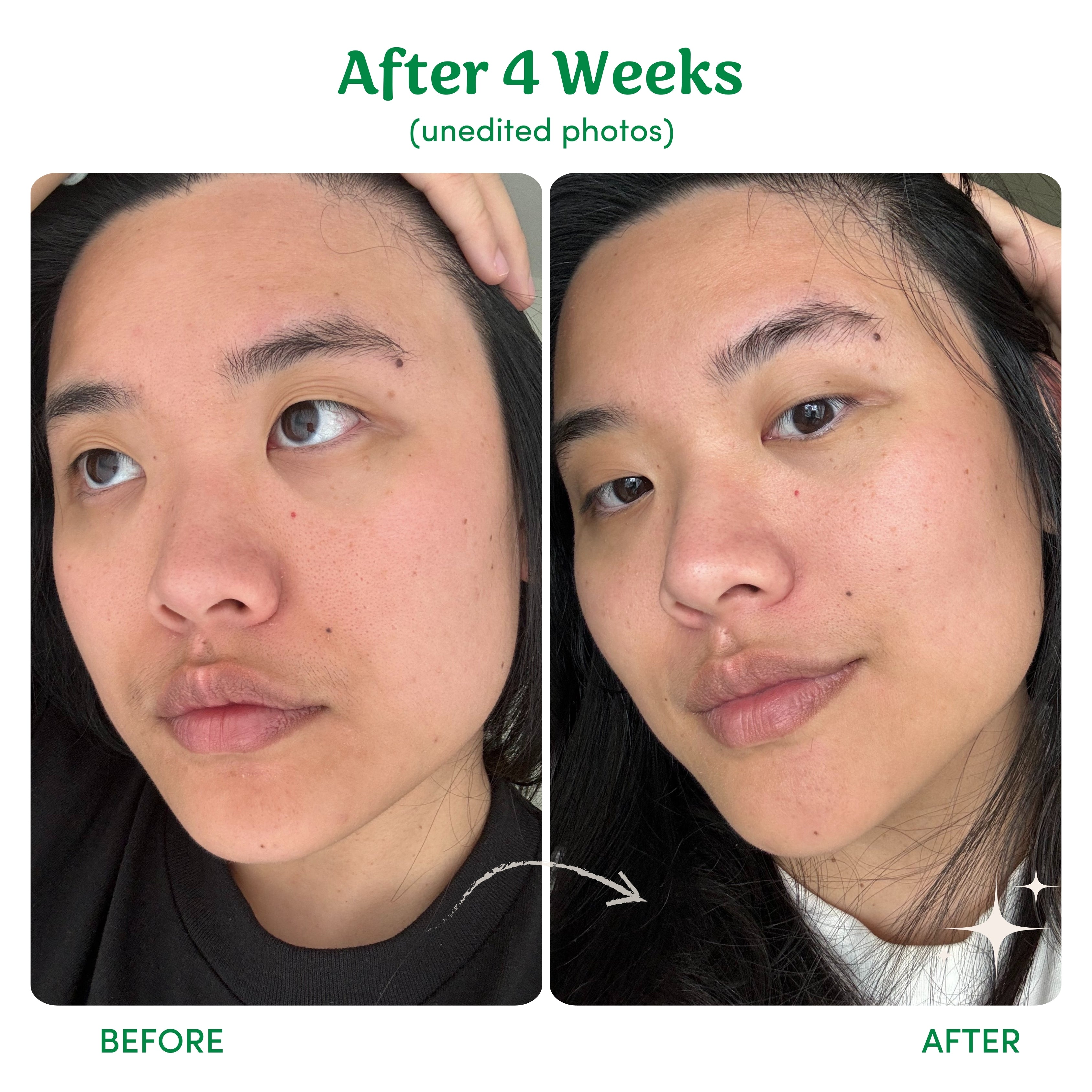 Lighten, Tighten, Brighten (LTB) - 3 Step Skincare Bundle
