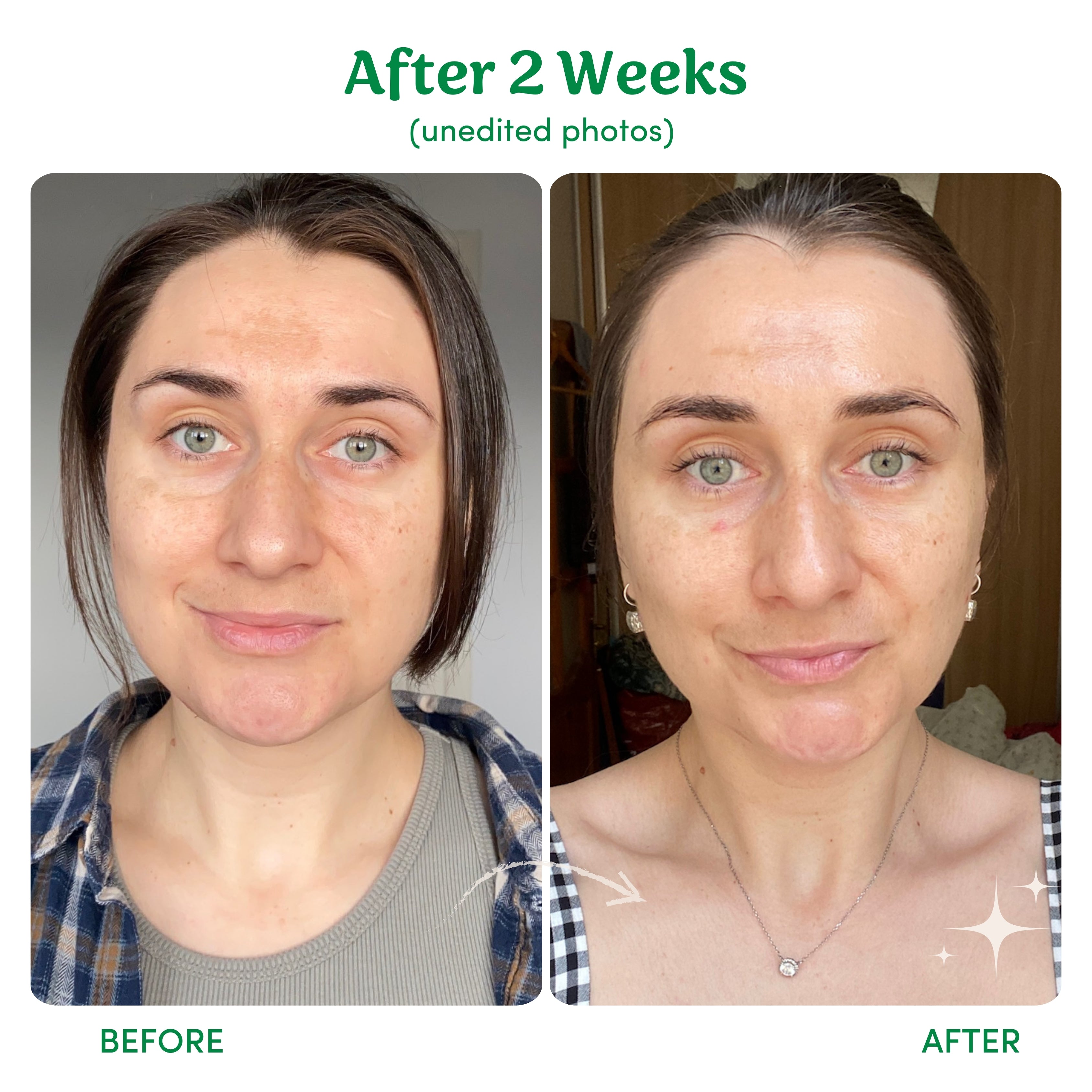 Lighten, Tighten, Brighten (LTB) - 3 Step Skincare Bundle