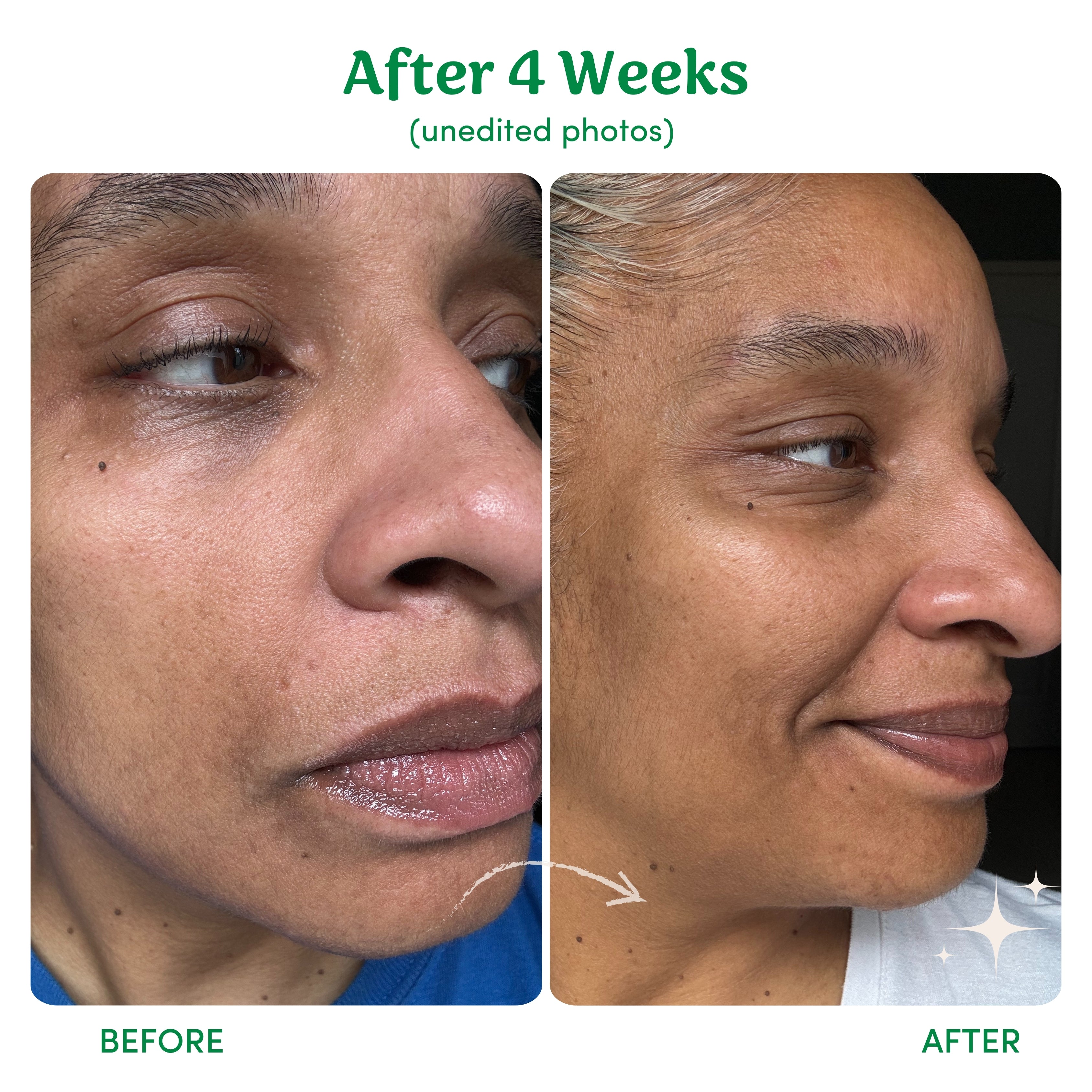 Lighten, Tighten, Brighten (LTB) - 3 Step Skincare Bundle
