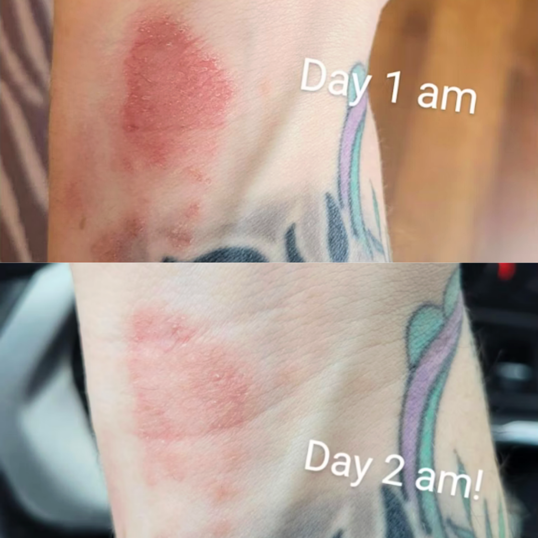Skin Food